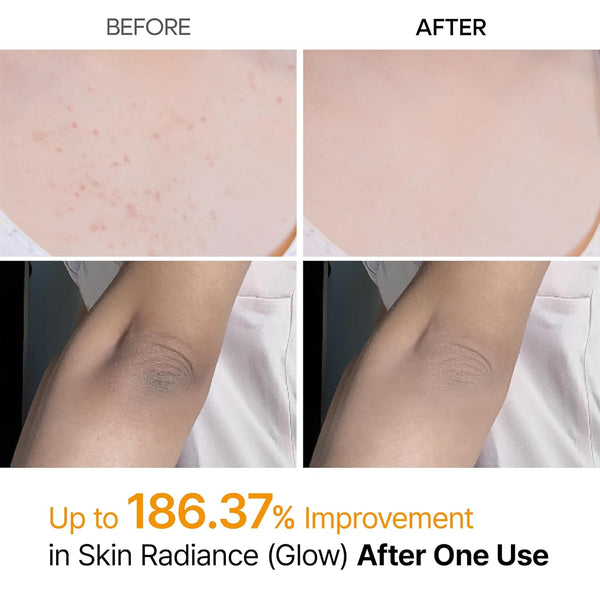 Spray Exfoliante Aclarador