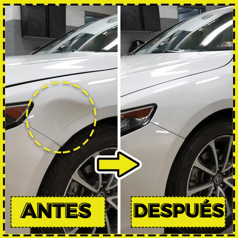 Desabollador Portátil para Autos™️ (ENVÍOS GRATIS + PAGA EN CASA)